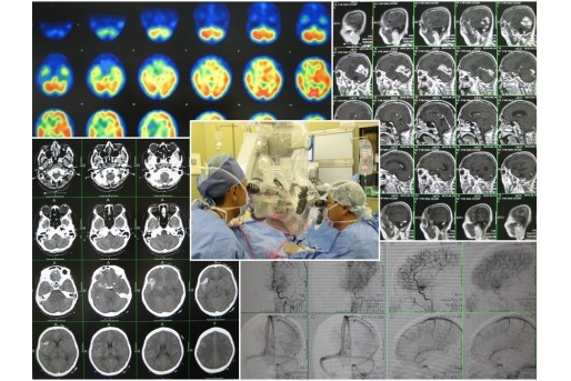 脳神経外科の写真